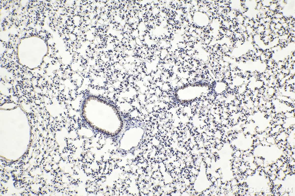 Immunohistochemistry (IHC) staining of mouse lung tissue using IWS1 Polyclonal antibody (16943-1-AP)