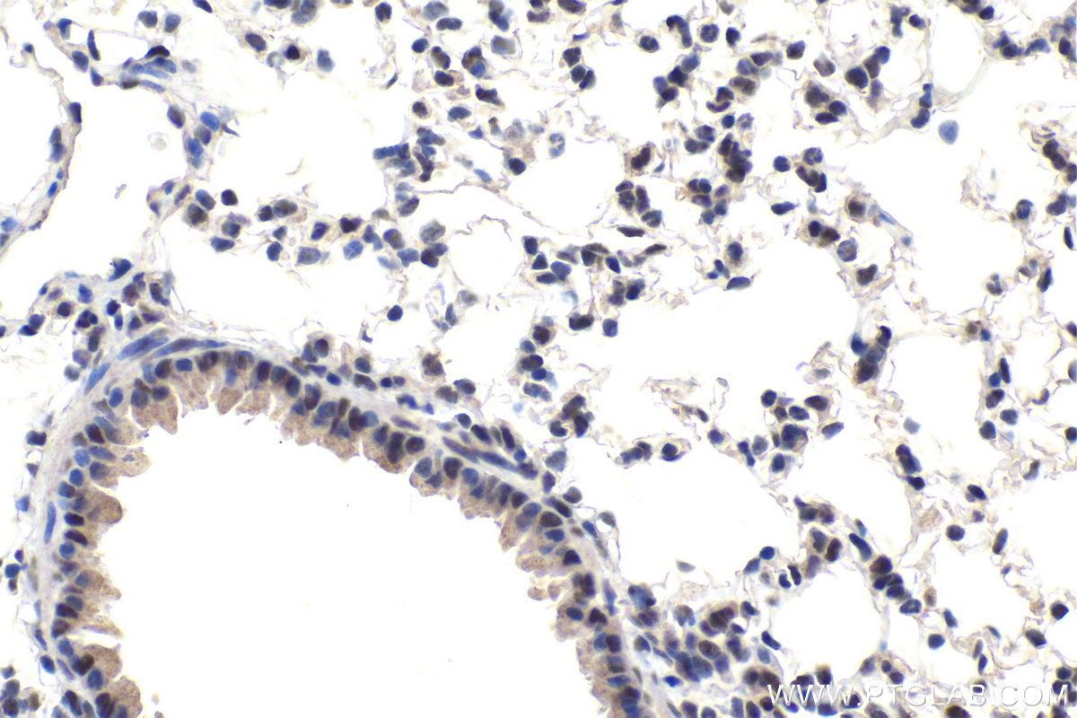 Immunohistochemistry (IHC) staining of mouse lung tissue using IWS1 Polyclonal antibody (16943-1-AP)