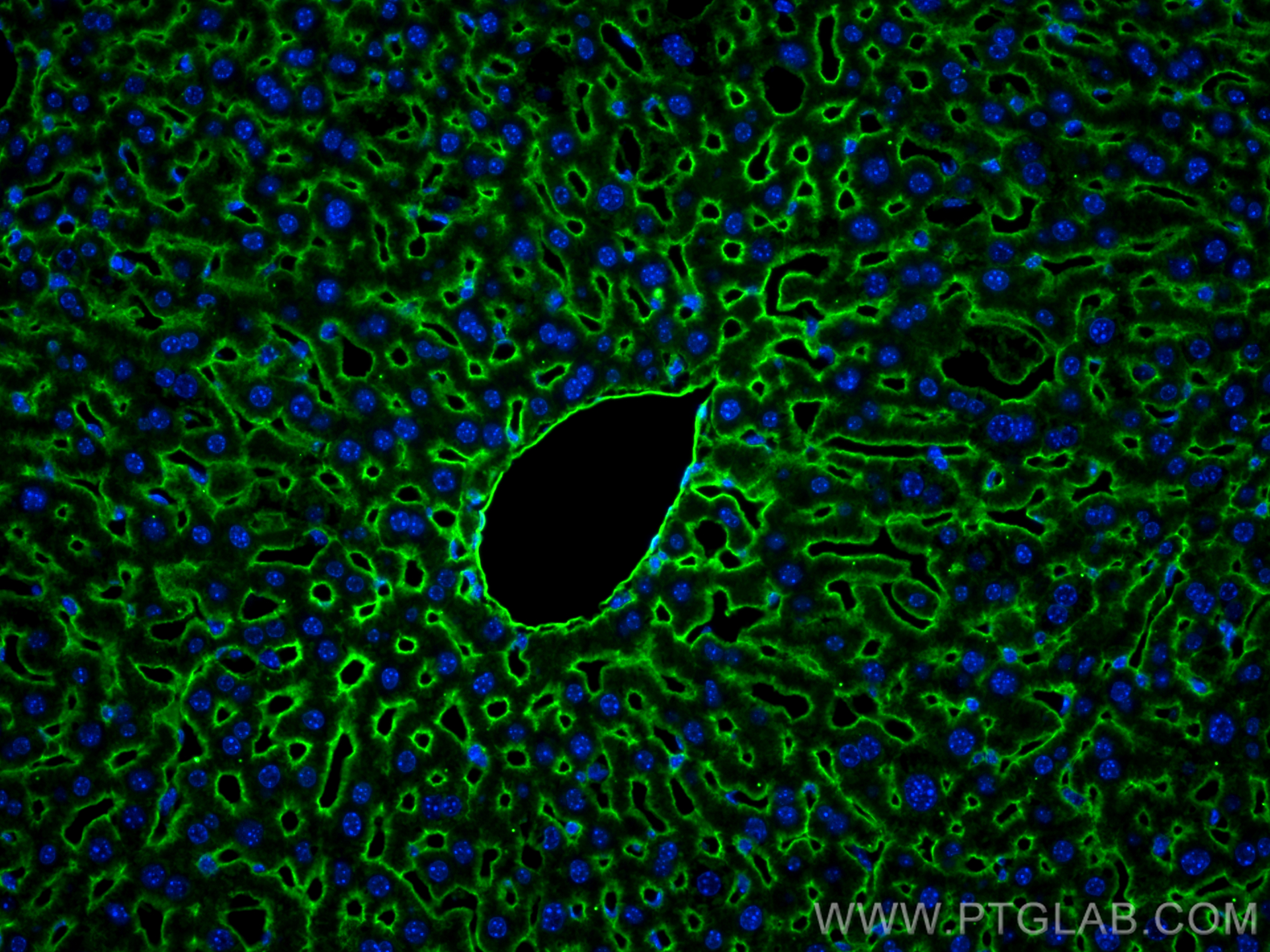 Immunofluorescence (IF) / fluorescent staining of mouse liver tissue using Icam-1 Polyclonal antibody (30324-1-AP)