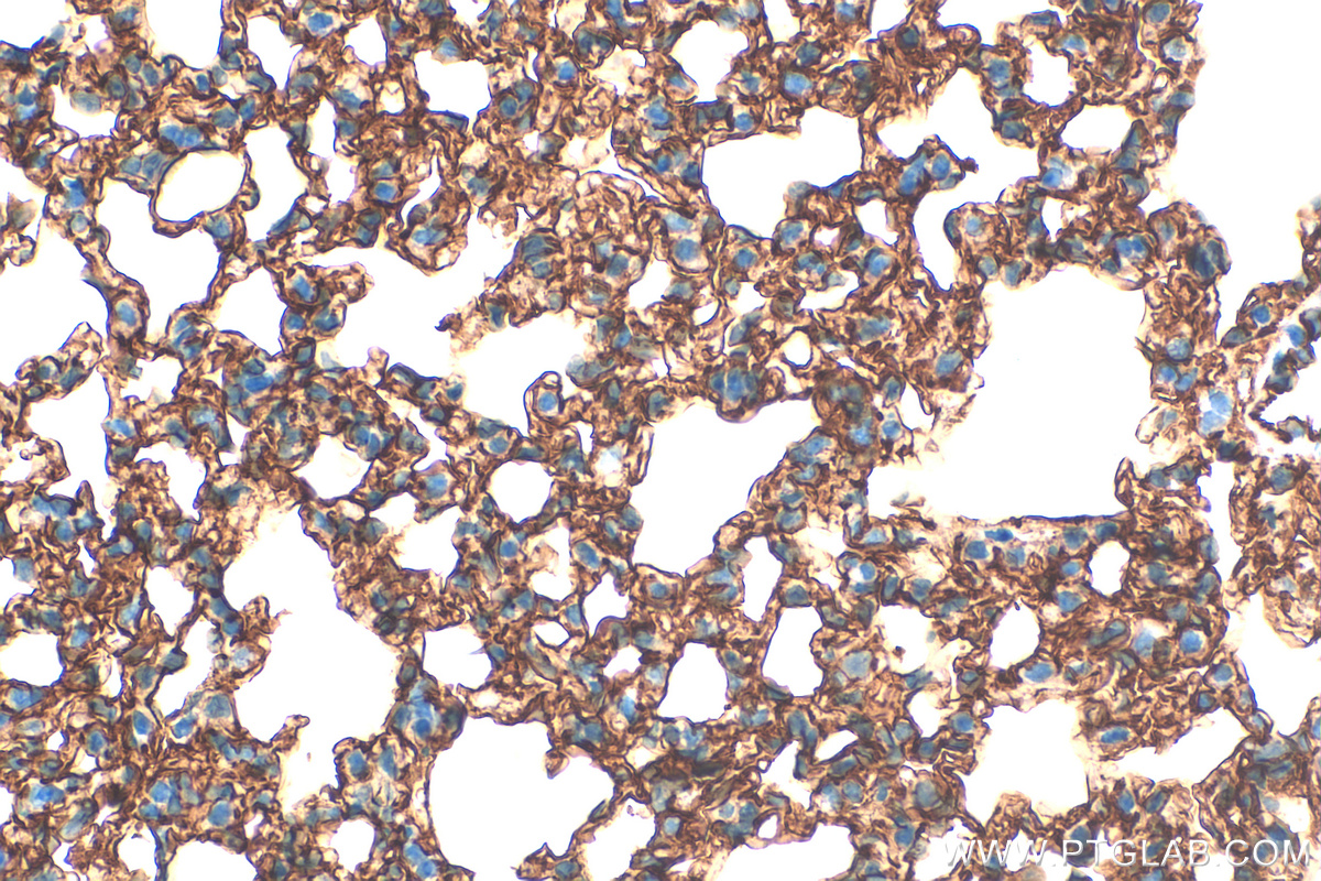 Immunohistochemistry (IHC) staining of mouse lung tissue using Icam-1 Polyclonal antibody (30324-1-AP)