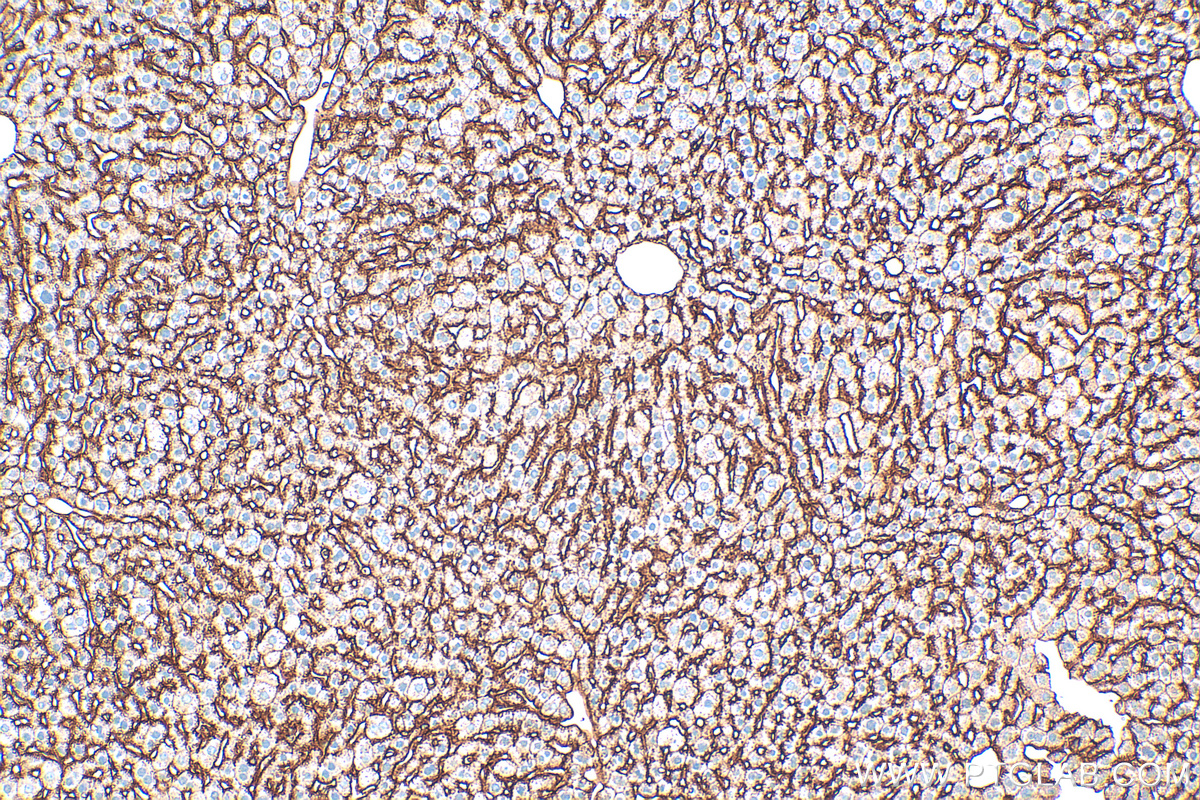 Immunohistochemistry (IHC) staining of mouse liver tissue using Icam-1 Polyclonal antibody (30324-1-AP)