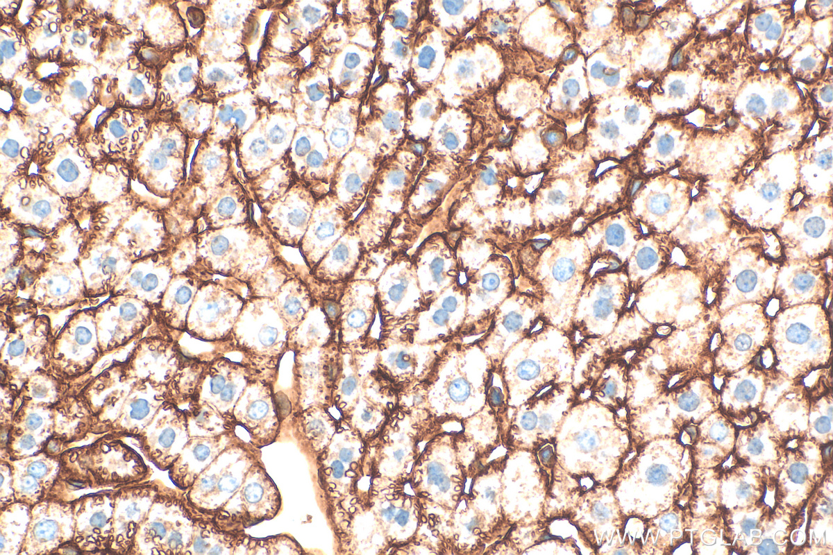 Immunohistochemistry (IHC) staining of mouse liver tissue using Icam-1 Polyclonal antibody (30324-1-AP)