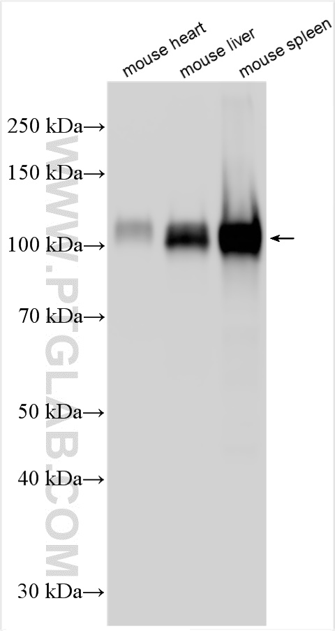 Western Blot (WB) analysis of various lysates using Icam-1 Polyclonal antibody (30324-1-AP)