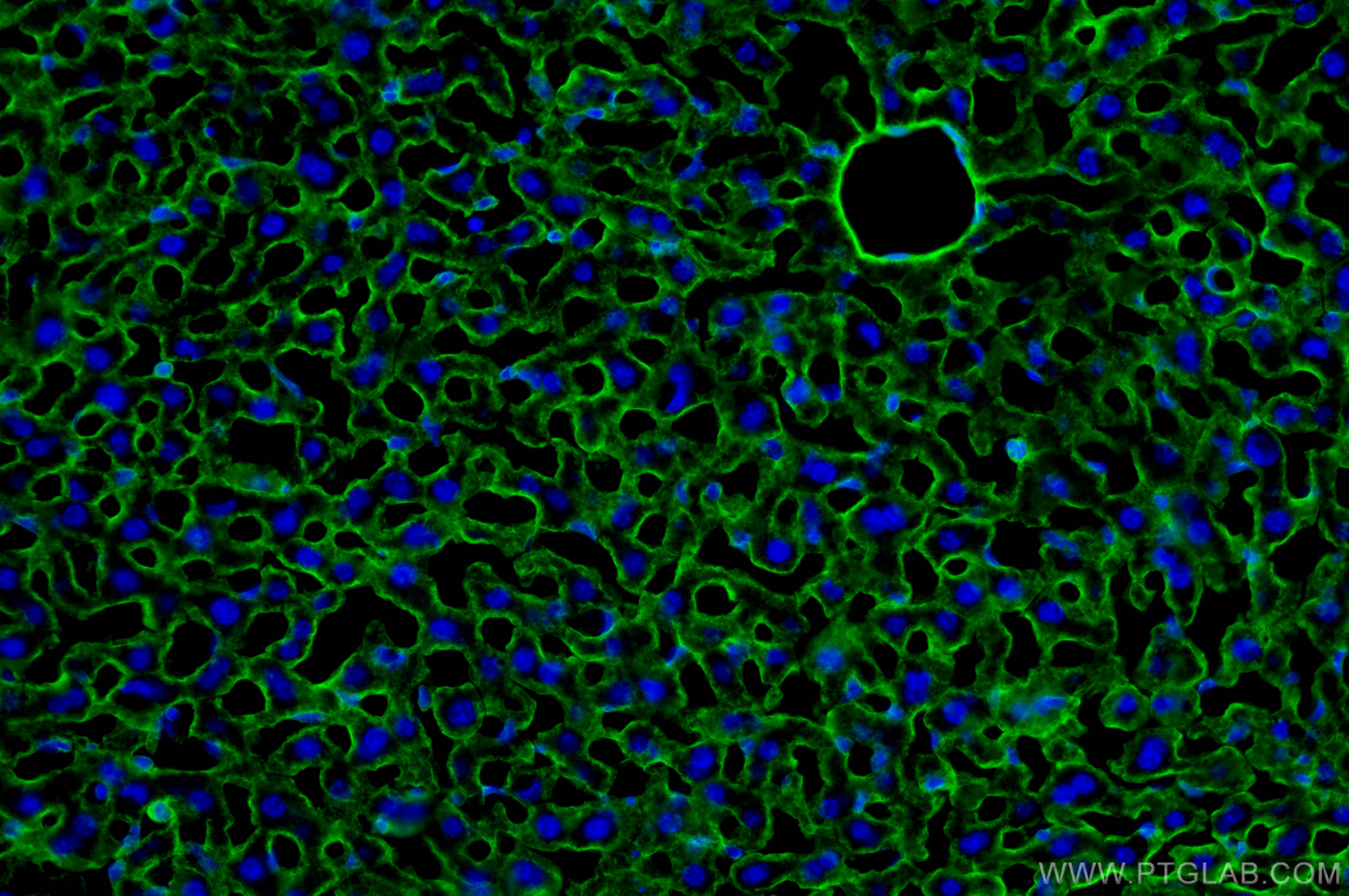 Immunofluorescence (IF) / fluorescent staining of mouse liver tissue using ICAM-1/CD54 Polyclonal antibody (10020-1-AP)