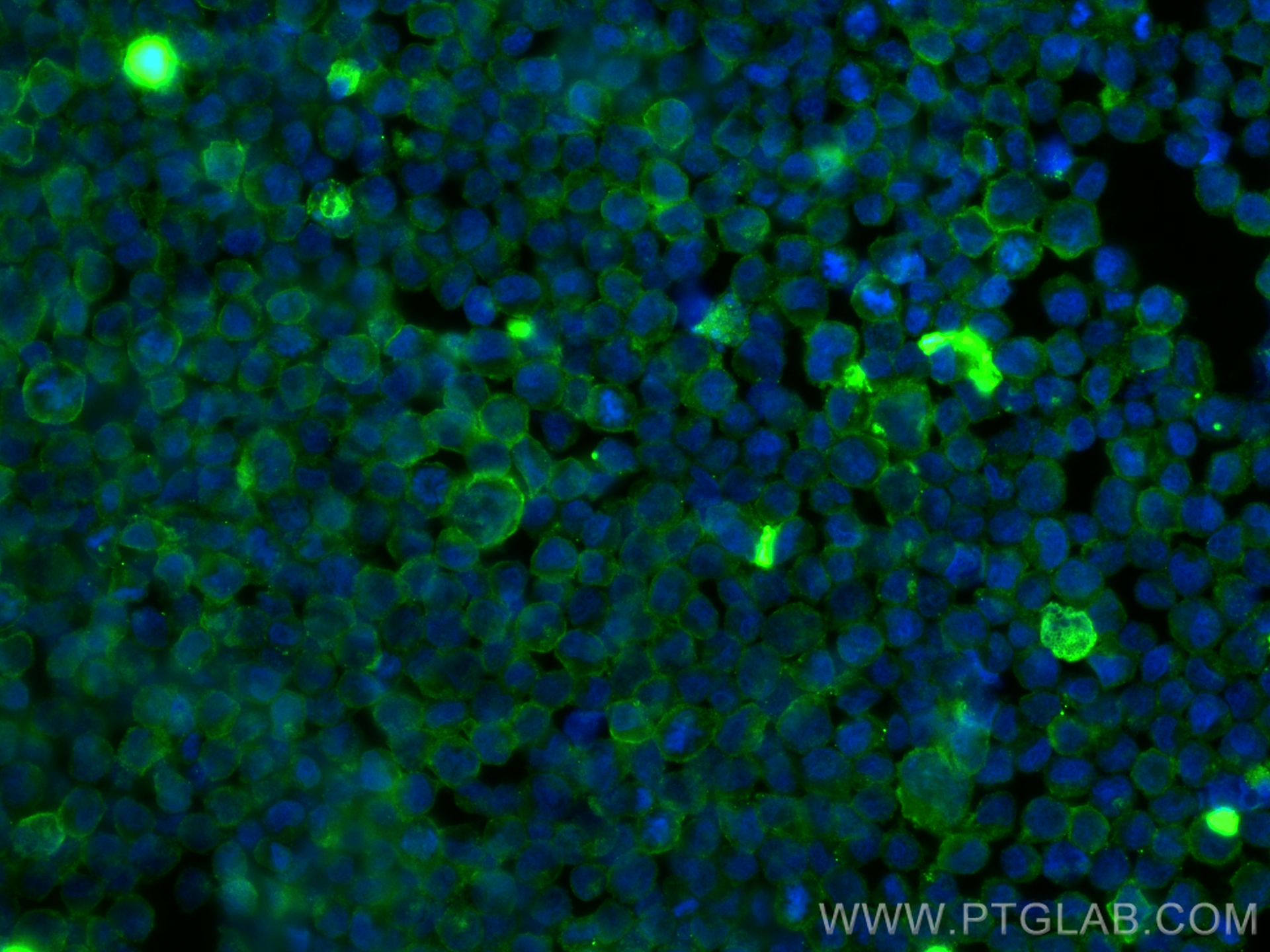 Immunofluorescence (IF) / fluorescent staining of Raji cells using ICAM-1/CD54 Polyclonal antibody (10020-1-AP)