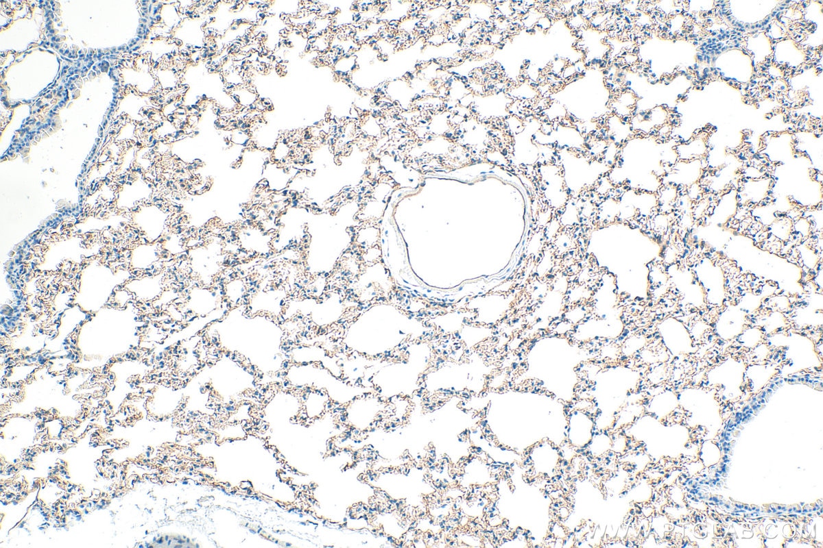 Immunohistochemistry (IHC) staining of mouse lung tissue using ICAM-1/CD54 Polyclonal antibody (10020-1-AP)