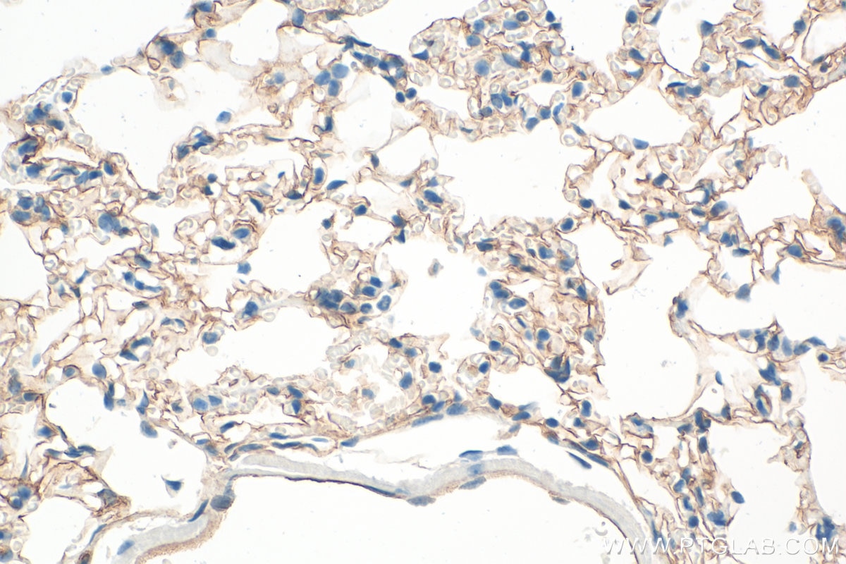 Immunohistochemistry (IHC) staining of mouse lung tissue using ICAM-1/CD54 Polyclonal antibody (10020-1-AP)