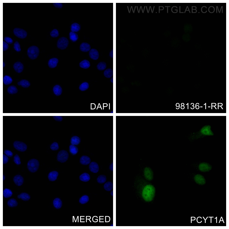 Immunofluorescence (IF) / fluorescent staining of MCF-7 cells using Rabbit IgG Isotype Control,  Rabbit Recombinant An (98136-1-RR)