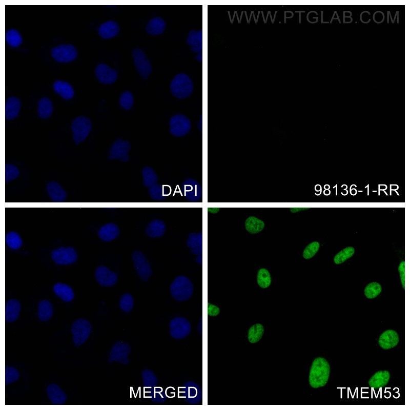 Immunofluorescence (IF) / fluorescent staining of A549 cells using Rabbit IgG Isotype Control Recombinant Antibody (98136-1-RR)