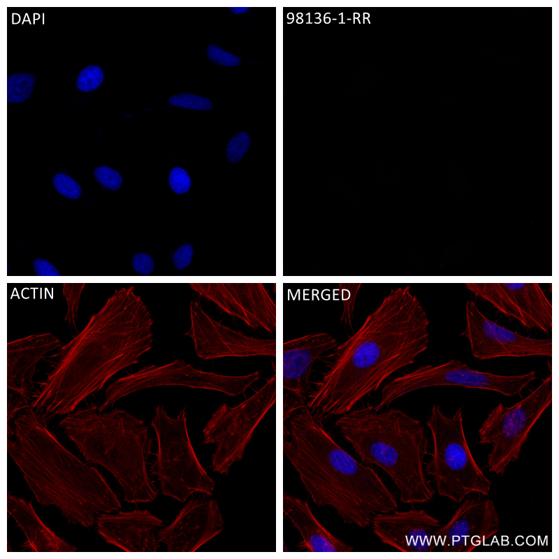 Immunofluorescence (IF) / fluorescent staining of HeLa cells using Rabbit IgG Isotype Control Recombinant Antibody (98136-1-RR)