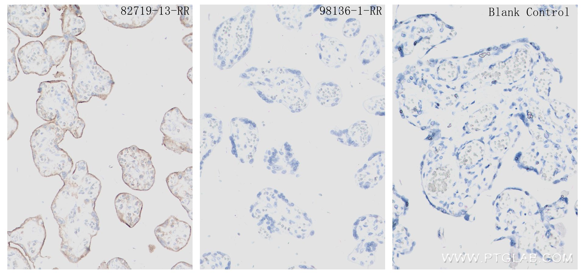 Immunohistochemistry (IHC) staining of human placenta tissue using Rabbit IgG Isotype Control Recombinant Antibody (98136-1-RR)