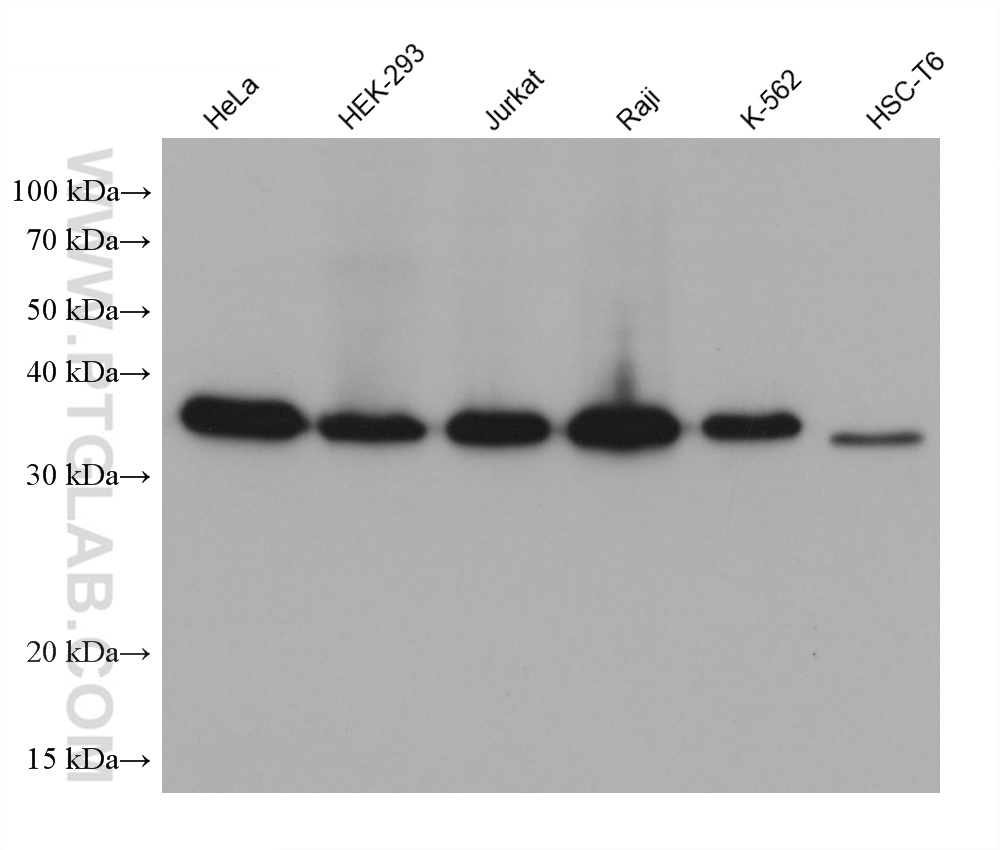 Western Blot (WB) analysis of various lysates using IkB Alpha Monoclonal antibody (66418-1-Ig)