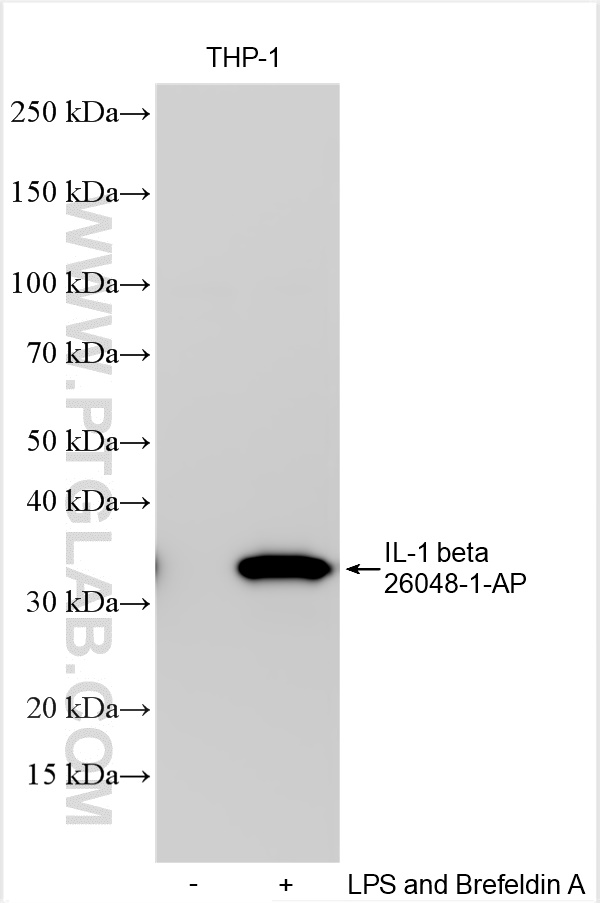 Western Blot (WB) analysis of various lysates using IL-1 beta Polyclonal antibody (26048-1-AP)