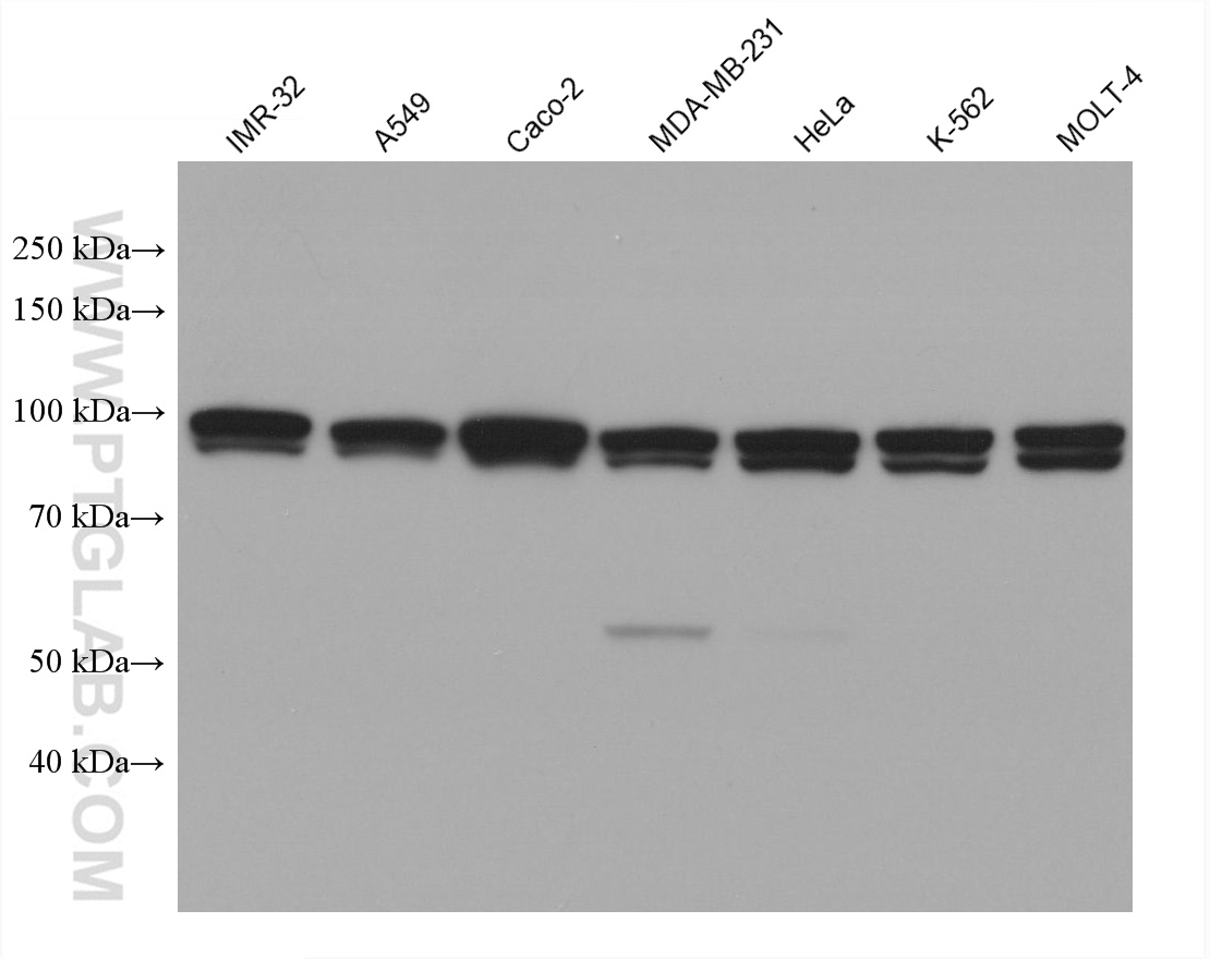 Western Blot (WB) analysis of various lysates using Importin Beta Monoclonal antibody (67597-1-Ig)