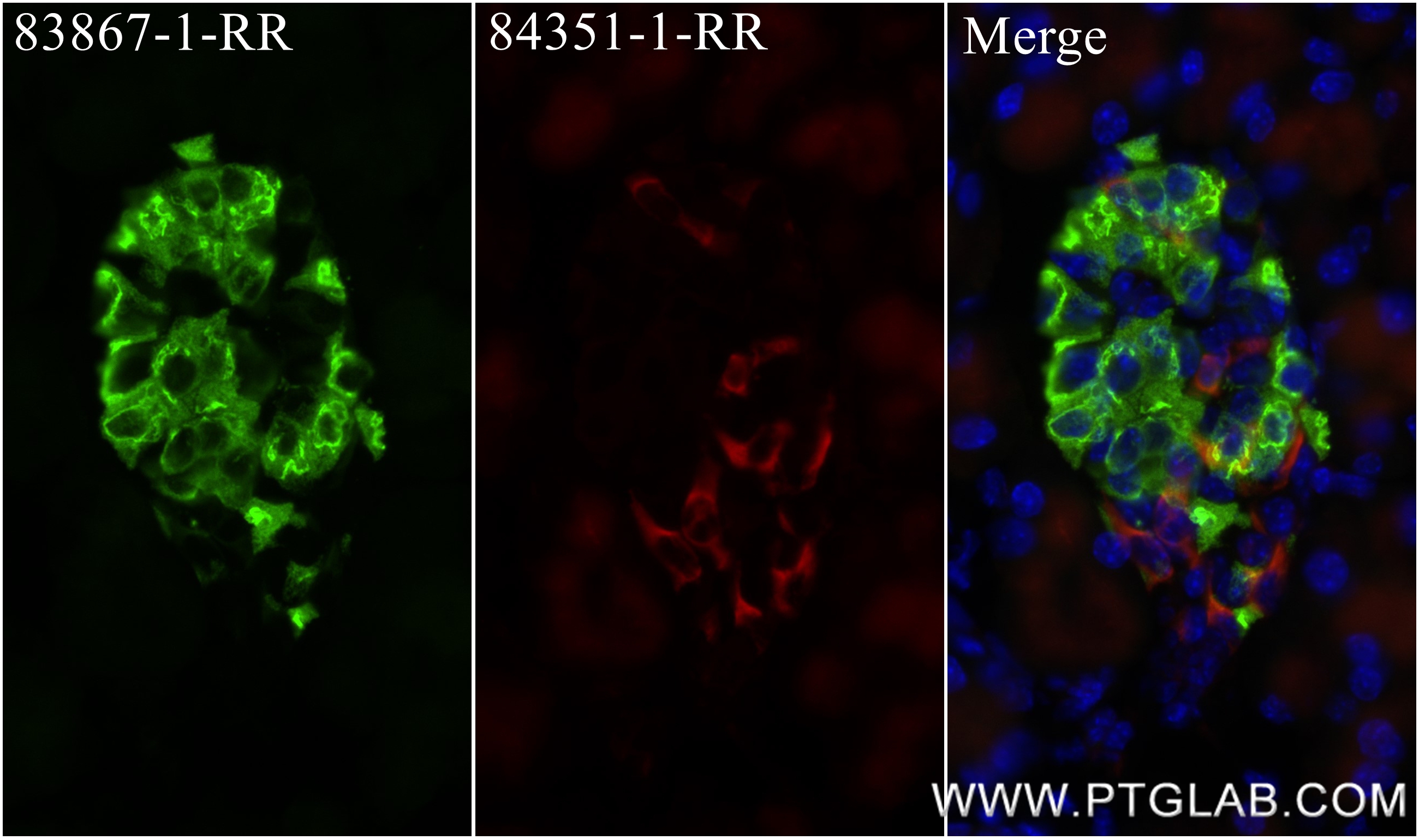 Immunofluorescence (IF) / fluorescent staining of mouse pancreas tissue using Ins1 Recombinant antibody (83867-1-RR)