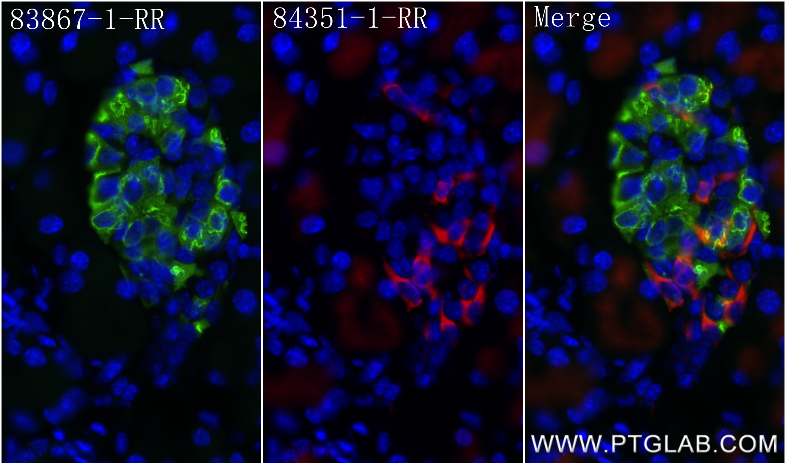 Immunofluorescence (IF) / fluorescent staining of mouse pancreas tissue using Ins1 Recombinant antibody (83867-1-RR)