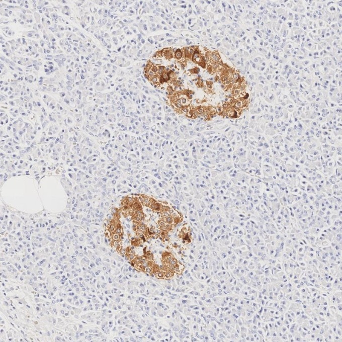 Immunohistochemistry (IHC) staining of human pancreas tissue using INS Monoclonal antibody (66198-1-Ig)