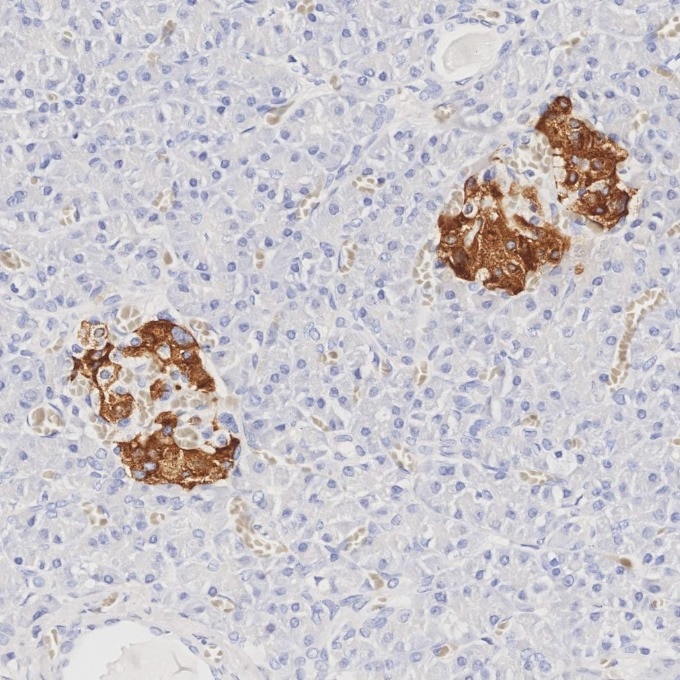 Immunohistochemistry (IHC) staining of human pancreas tissue using INS Monoclonal antibody (66198-1-Ig)