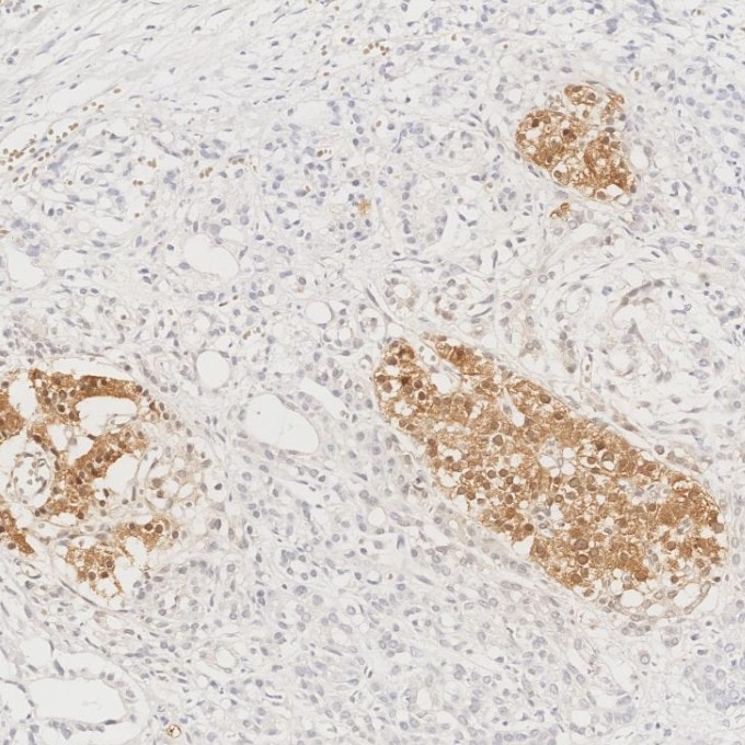 Immunohistochemistry (IHC) staining of human pancreas tissue using INS Monoclonal antibody (66198-1-Ig)