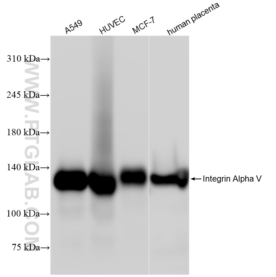 Western Blot (WB) analysis of various lysates using Integrin Alpha V Recombinant antibody (84883-5-RR)