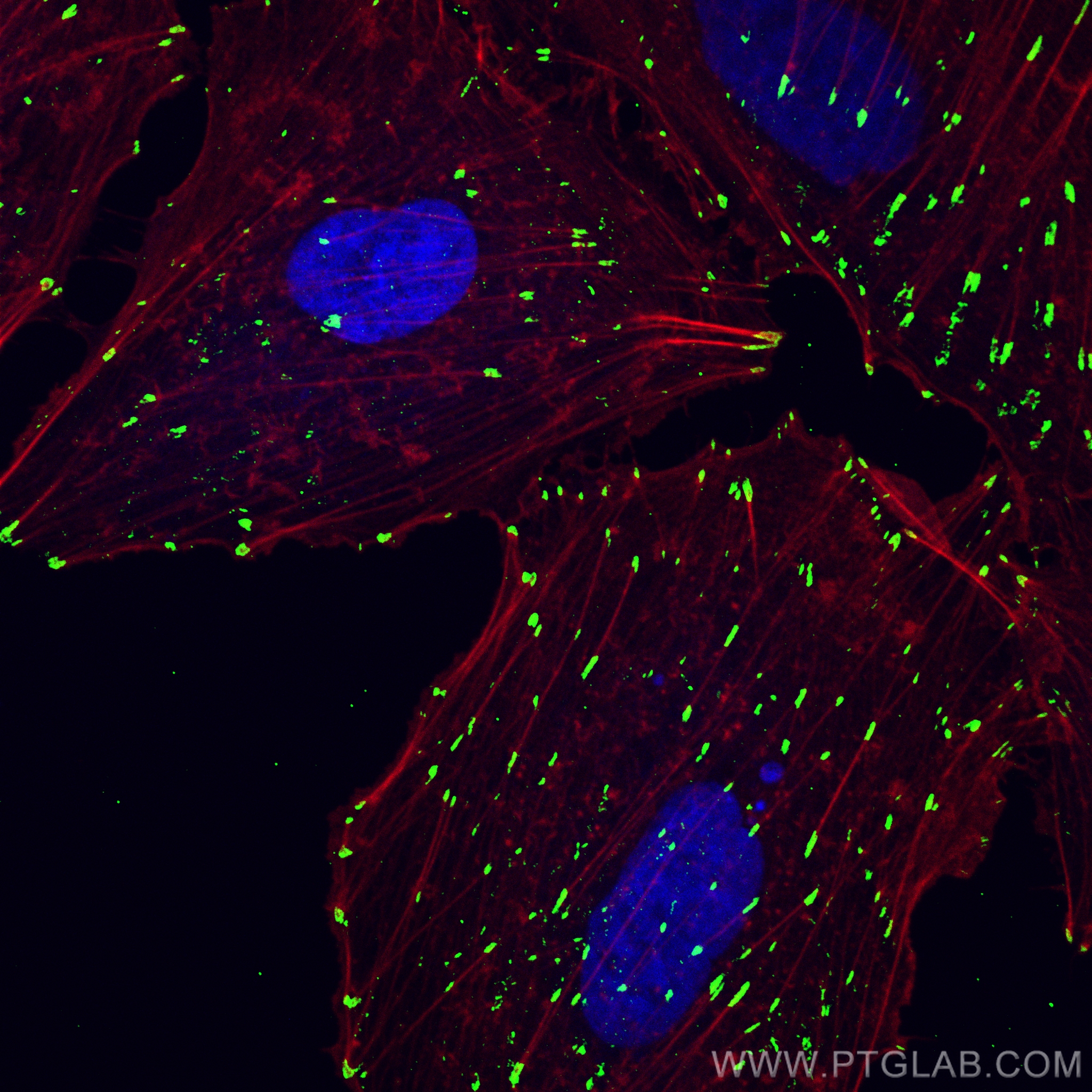 Immunofluorescence (IF) / fluorescent staining of A549 cells using CoraLite® Plus 488-conjugated Integrin Alpha V Pol (CL488-27096)