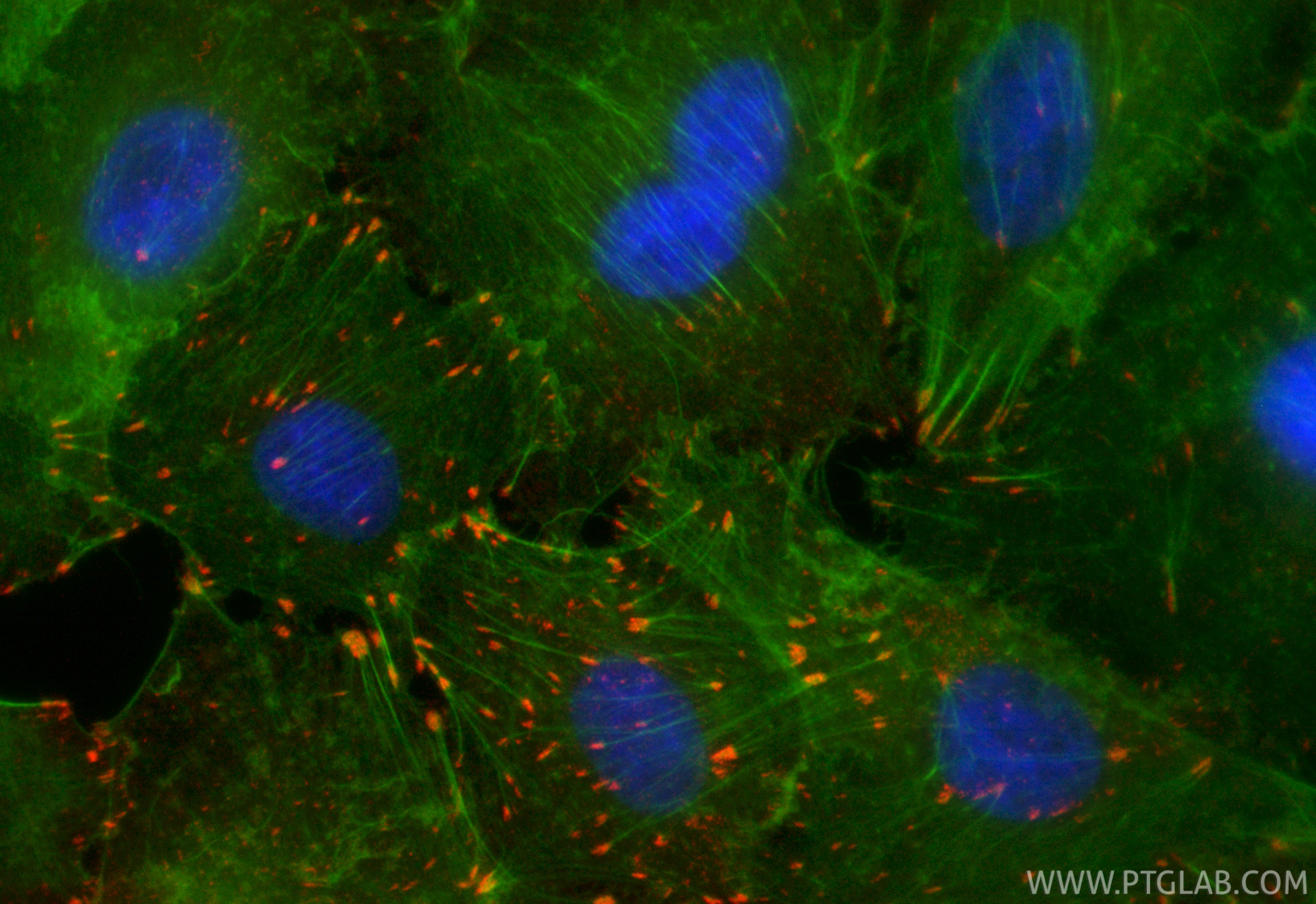 Immunofluorescence (IF) / fluorescent staining of A549 cells using CoraLite®594-conjugated Integrin Alpha V Recombina (CL594-84883-5)