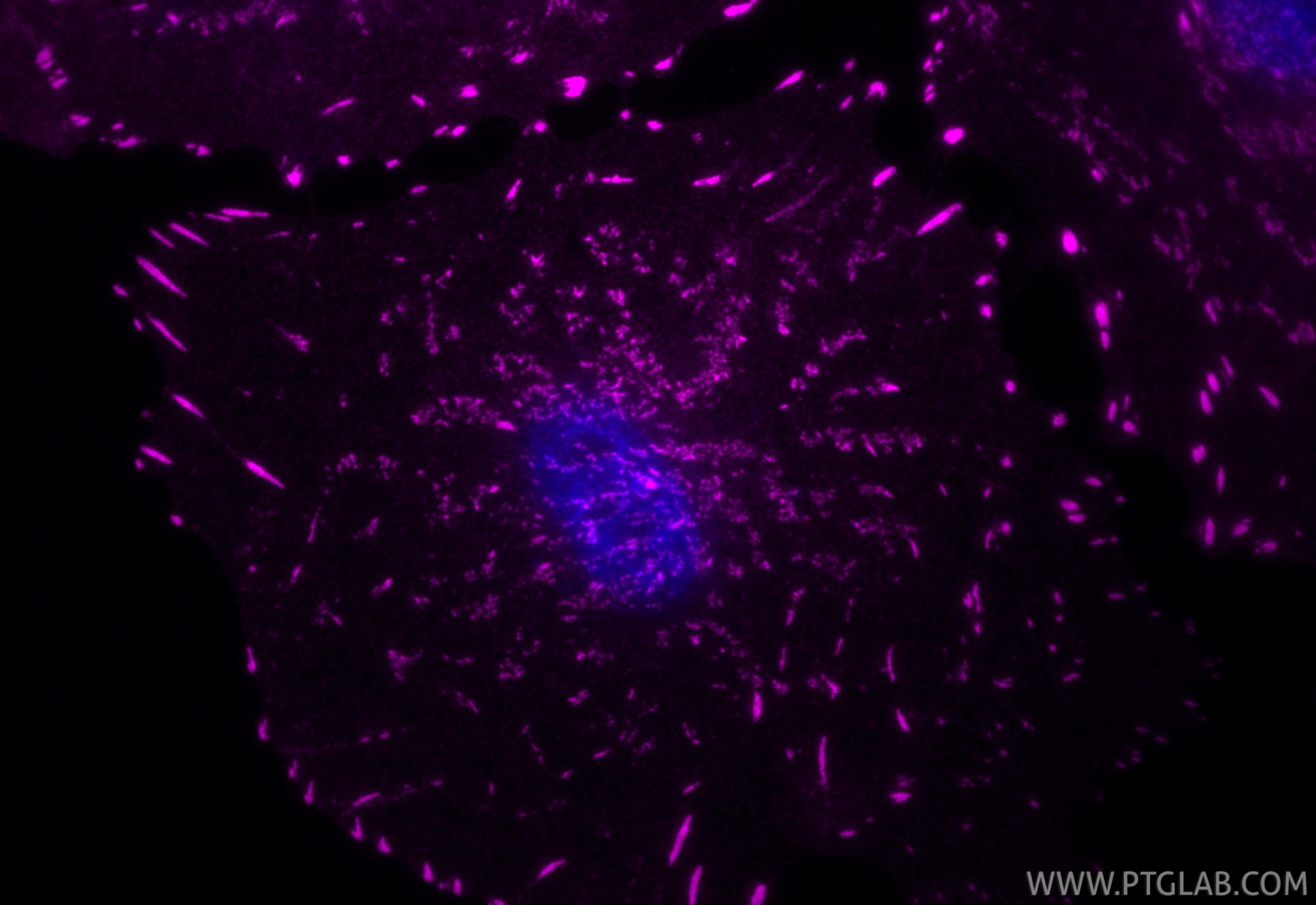 Immunofluorescence (IF) / fluorescent staining of A549 cells using CoraLite® Plus 647-conjugated Integrin Alpha V Rec (CL647-84883-5)
