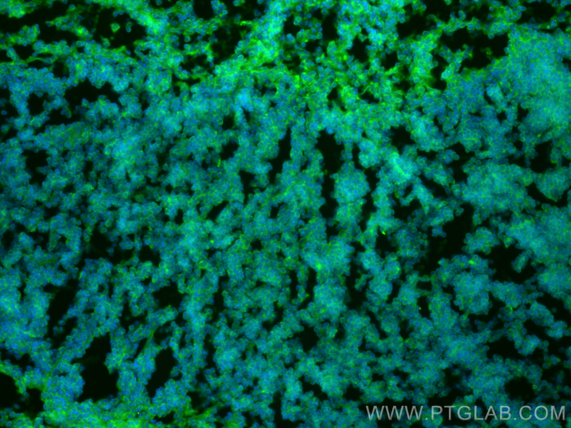 Immunofluorescence (IF) / fluorescent staining of mouse spleen tissue using Integrin alpha 1 Polyclonal antibody (29042-1-AP)