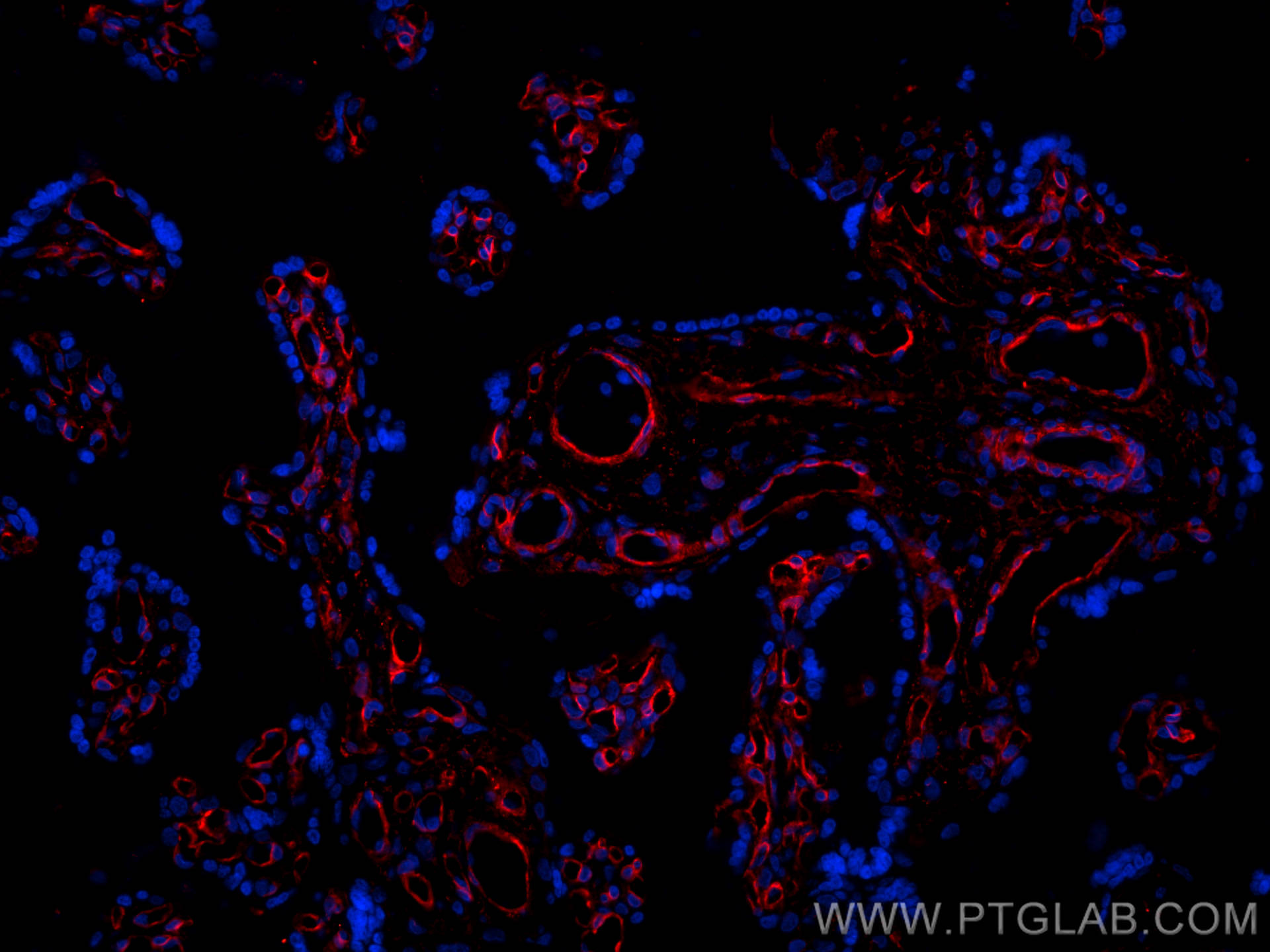 Immunofluorescence (IF) / fluorescent staining of human placenta tissue using Integrin alpha 1 Polyclonal antibody (29042-1-AP)