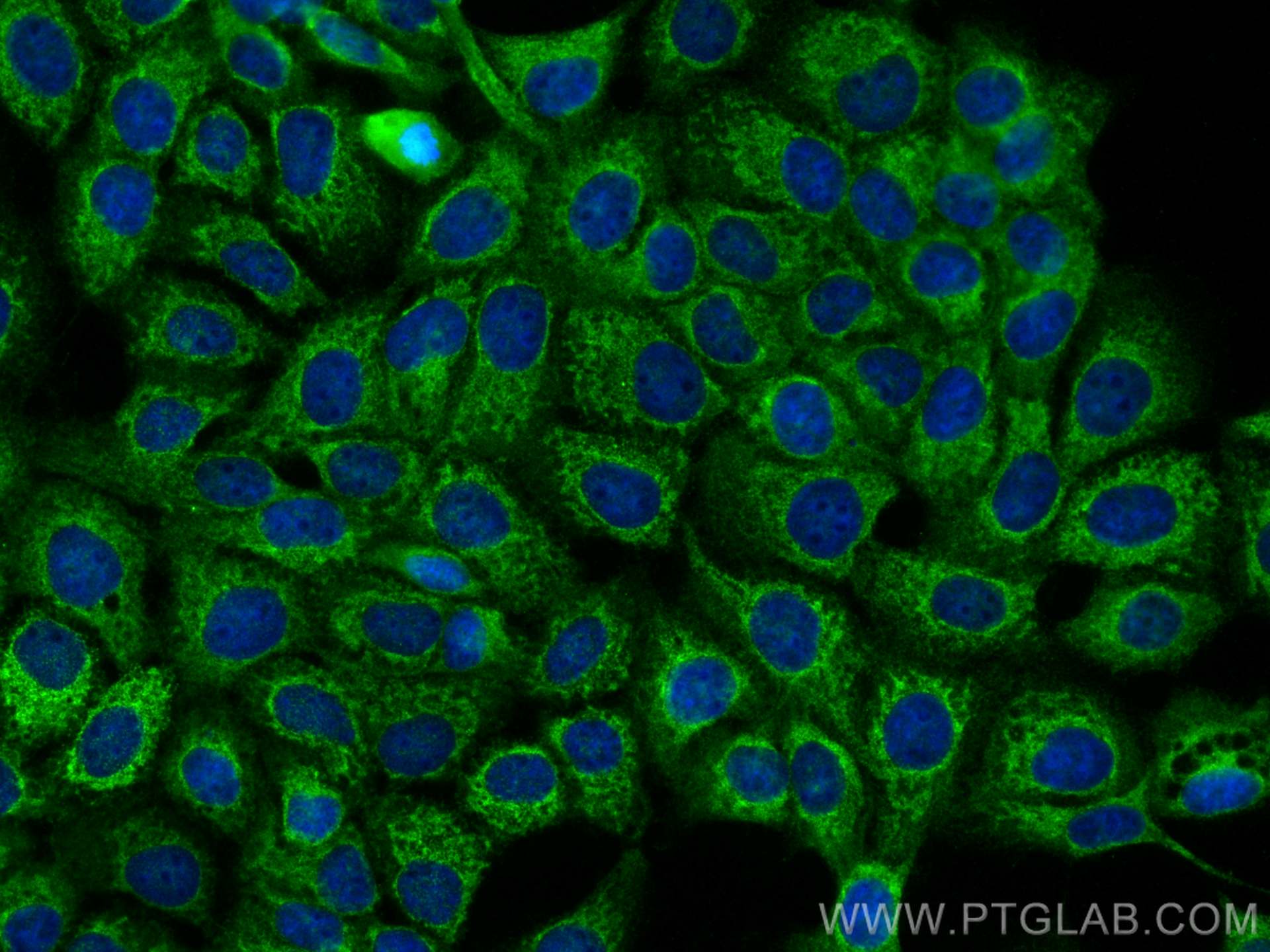 Immunofluorescence (IF) / fluorescent staining of A431 cells using Integrin alpha 2 Polyclonal antibody (30703-1-AP)