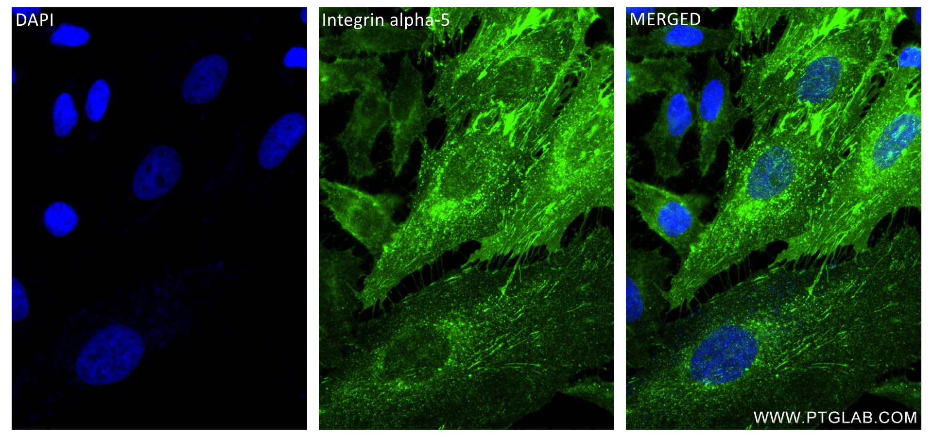 Immunofluorescence (IF) / fluorescent staining of HeLa cells using Integrin alpha-5 Recombinant antibody (84468-4-RR)