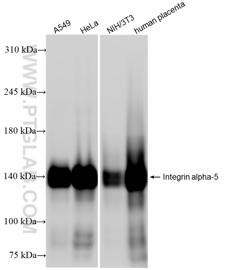 Western Blot (WB) analysis of various lysates using Integrin alpha-5 Recombinant antibody (84468-4-RR)