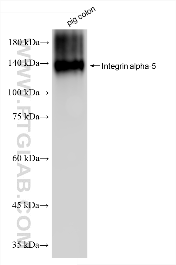 Western Blot (WB) analysis of pig colon tissue using Integrin alpha-5/CD49e Recombinant monoclonal anti (84468-4-RR)