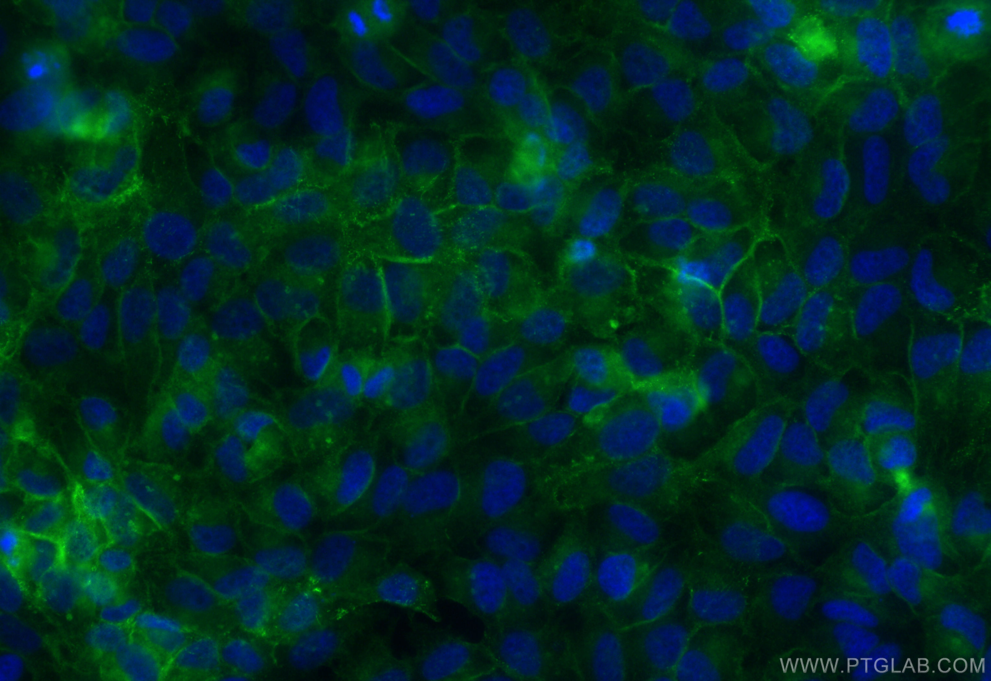 Immunofluorescence (IF) / fluorescent staining of HeLa cells using CoraLite® Plus 488-conjugated Integrin alpha-5 Rec (CL488-84468-4)