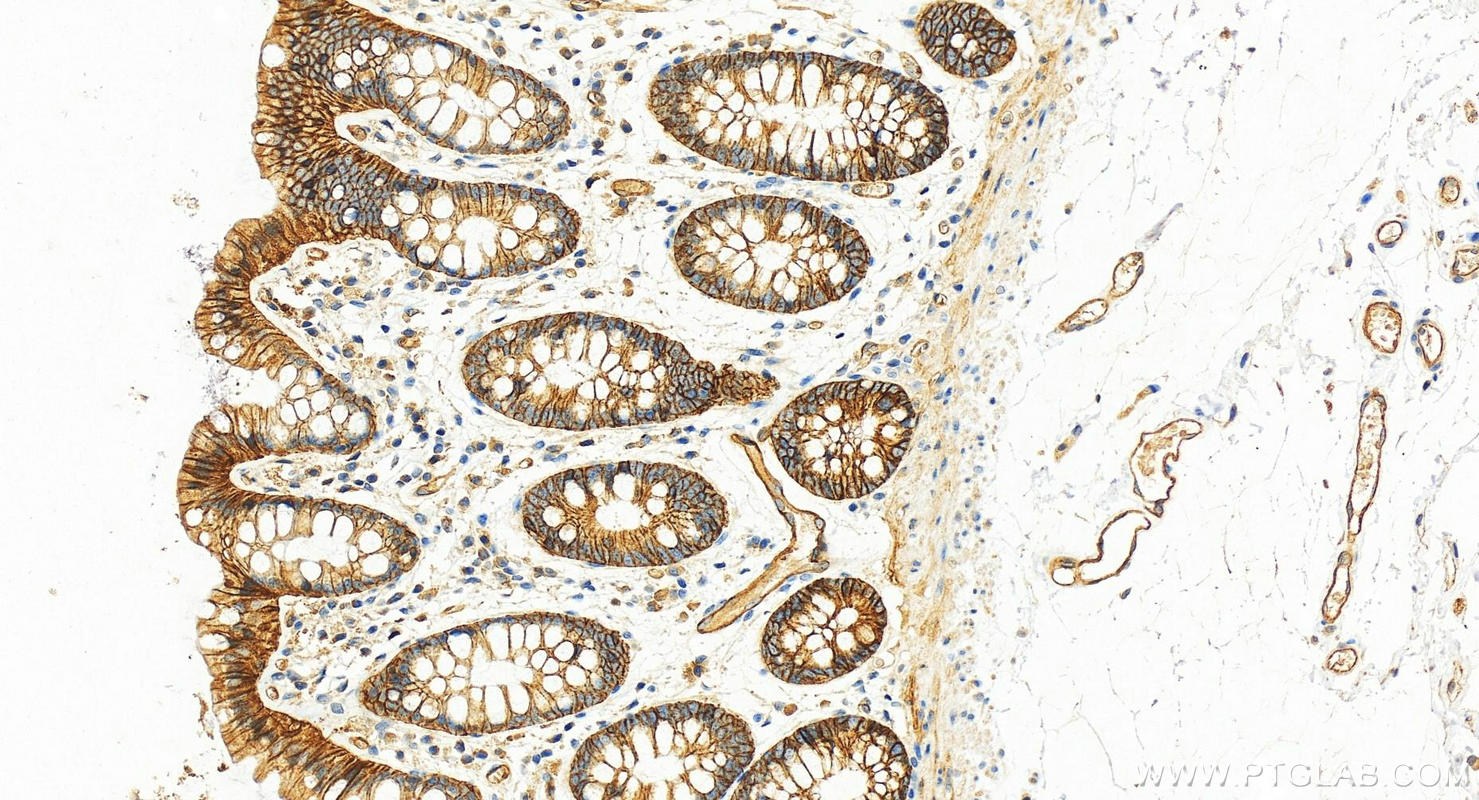 Immunohistochemistry (IHC) staining of human colon tissue using Integrin alpha 6 Polyclonal antibody (27189-1-AP)