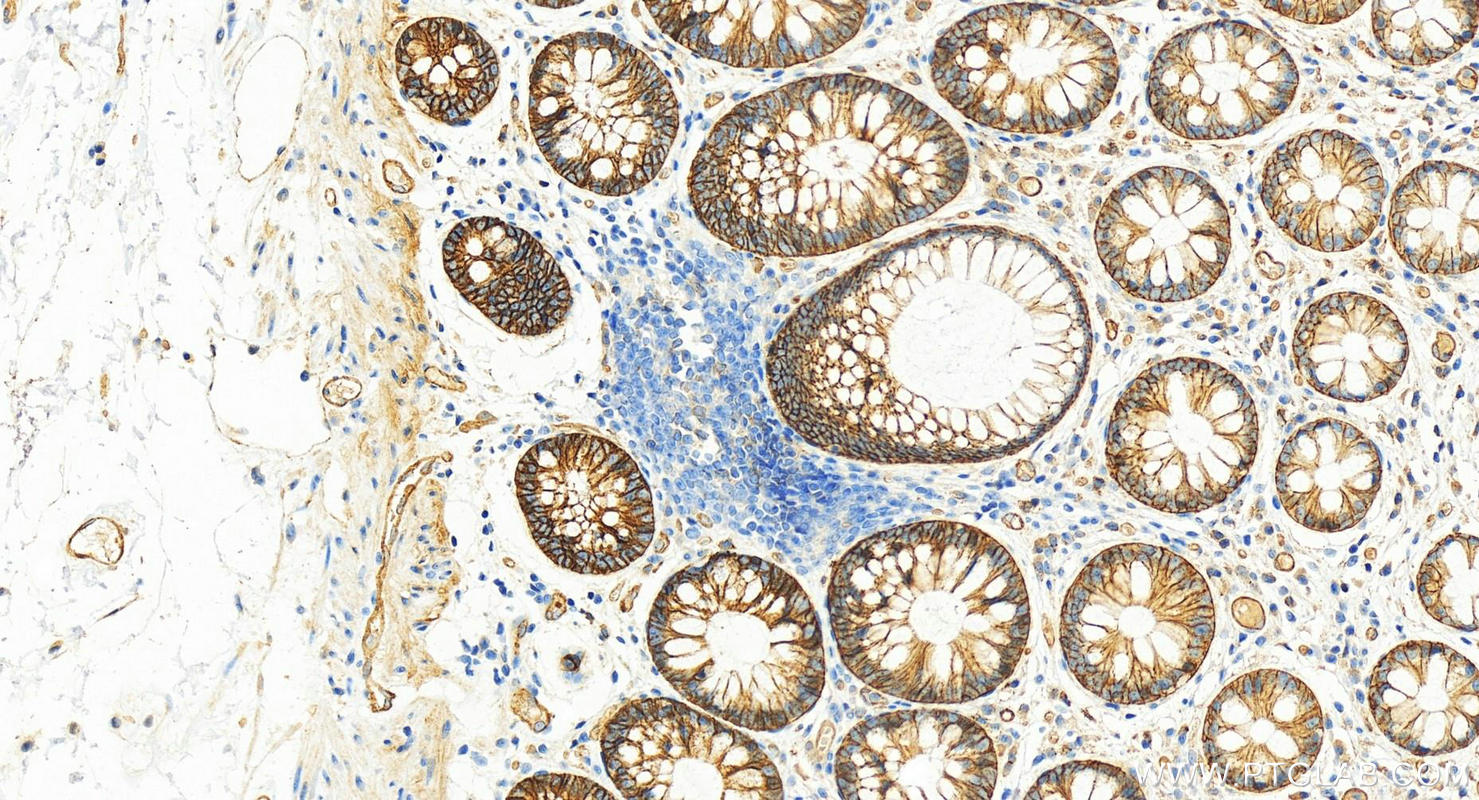 Immunohistochemistry (IHC) staining of human colon tissue using Integrin alpha 6 Polyclonal antibody (27189-1-AP)