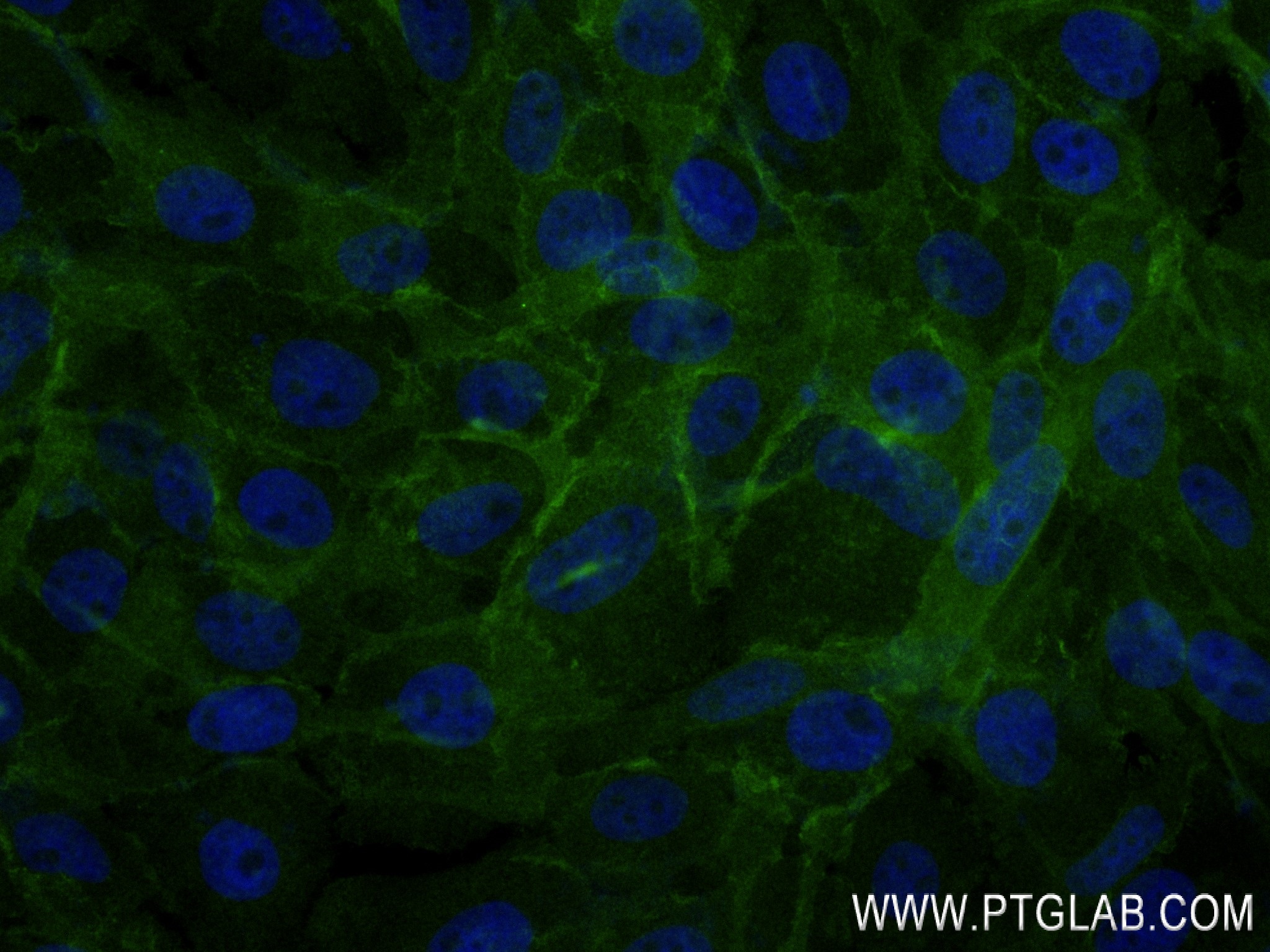 Immunofluorescence (IF) / fluorescent staining of A431 cells using Integrin alpha 6 Recombinant antibody (84463-2-RR)