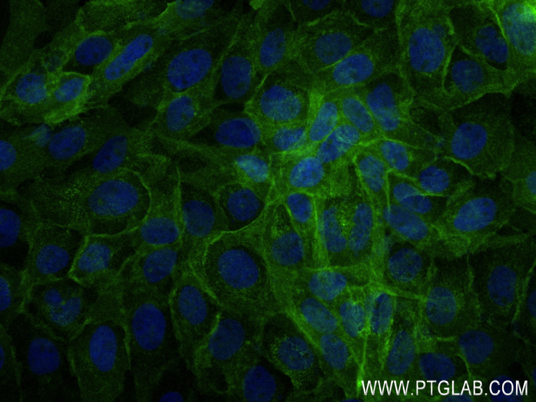 Immunofluorescence (IF) / fluorescent staining of A431 cells using Integrin alpha-6 Recombinant antibody (84463-3-RR)