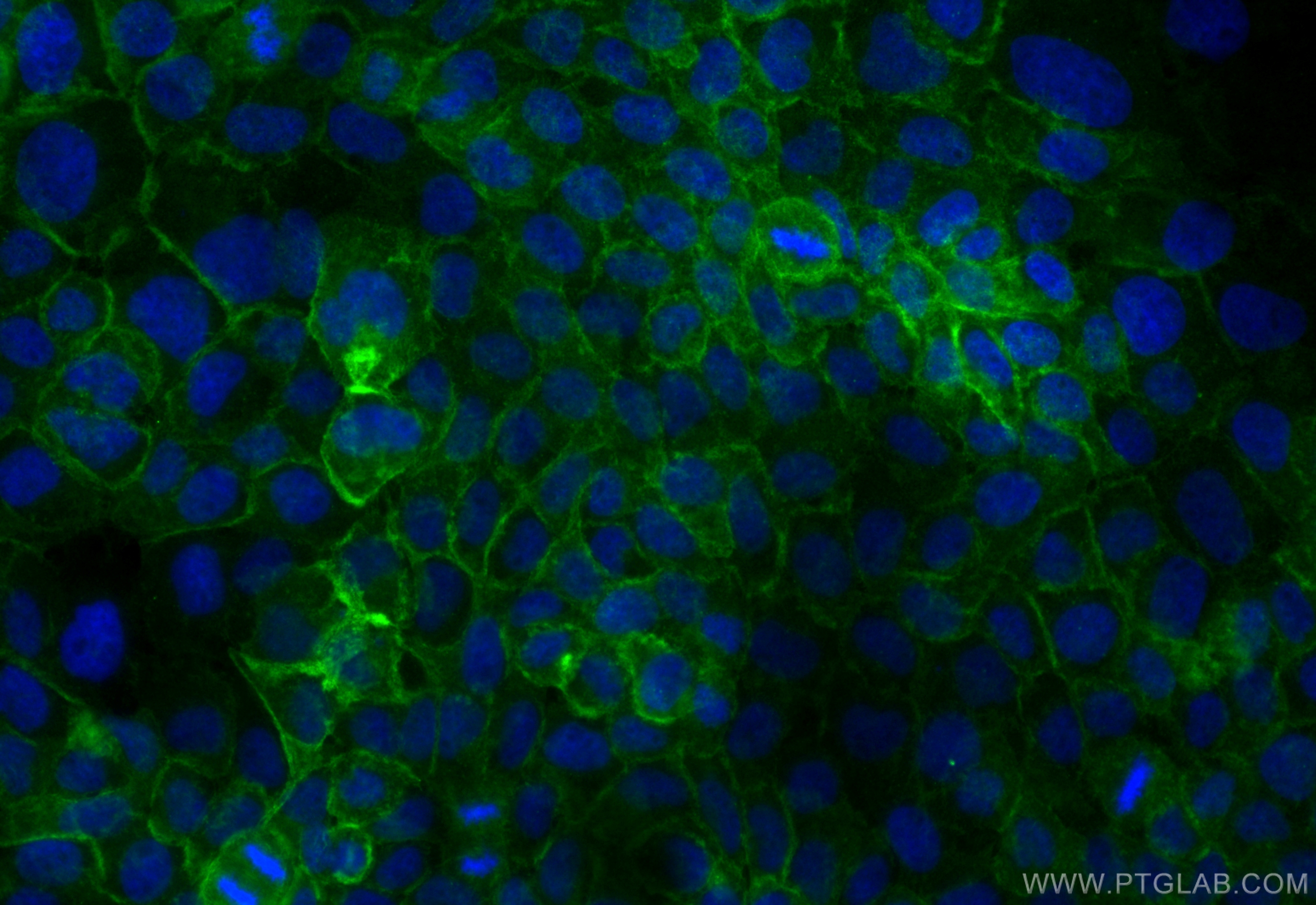 Immunofluorescence (IF) / fluorescent staining of A431 cells using CoraLite® Plus 488-conjugated Integrin alpha 6 Rec (CL488-84463-2)