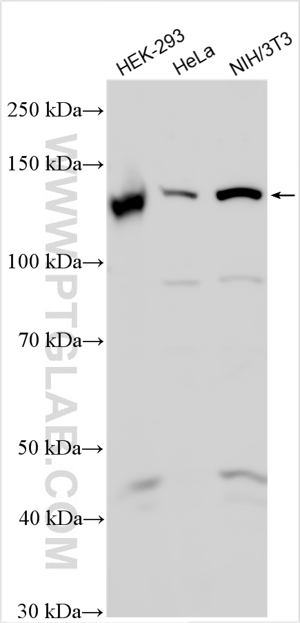 Western Blot (WB) analysis of various lysates using Integrin alpha 9 Polyclonal antibody (28348-1-AP)