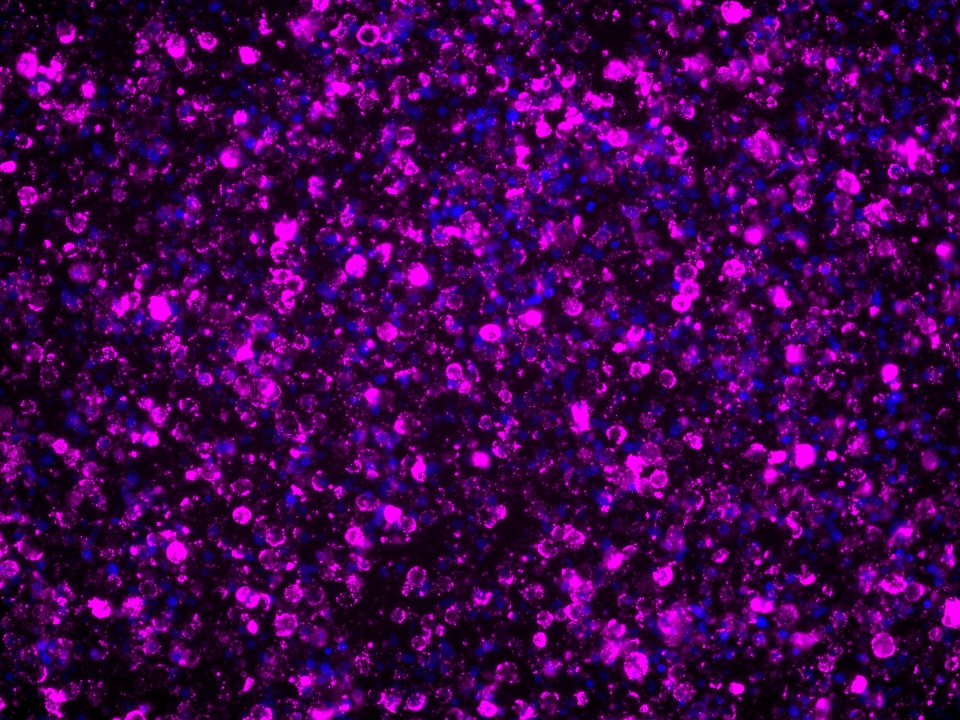 Immunofluorescence (IF) / fluorescent staining of human PBMCs using Integrin alpha-E Monoclonal antibody (68893-3-Ig)