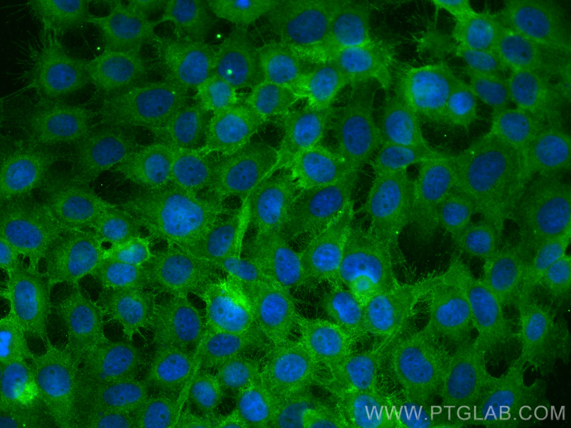 Immunofluorescence (IF) / fluorescent staining of A431 cells using Integrin Beta 4 Monoclonal antibody (66922-2-Ig)