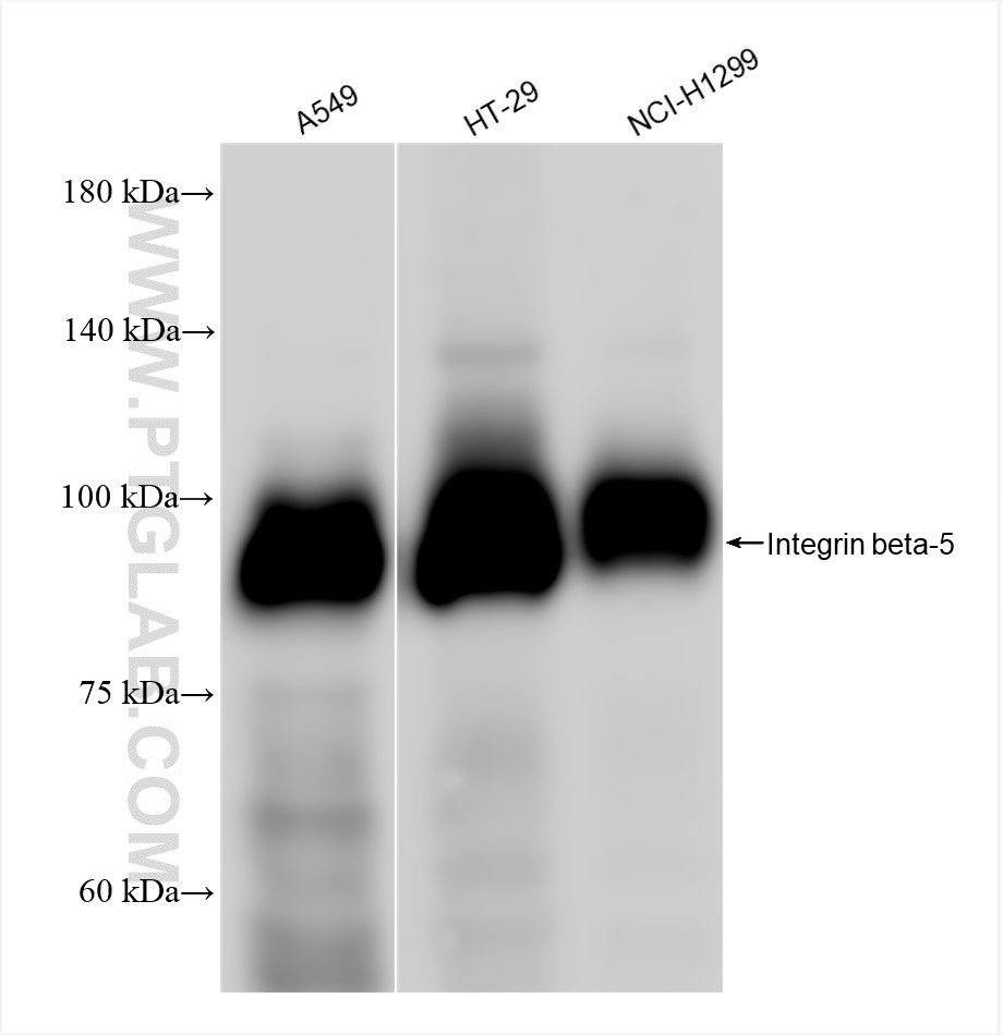 Western Blot (WB) analysis of various lysates using Integrin beta-5 Recombinant antibody (83514-3-RR)