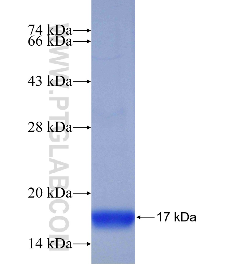 Integrin beta-5 fusion protein Ag29817 SDS-PAGE