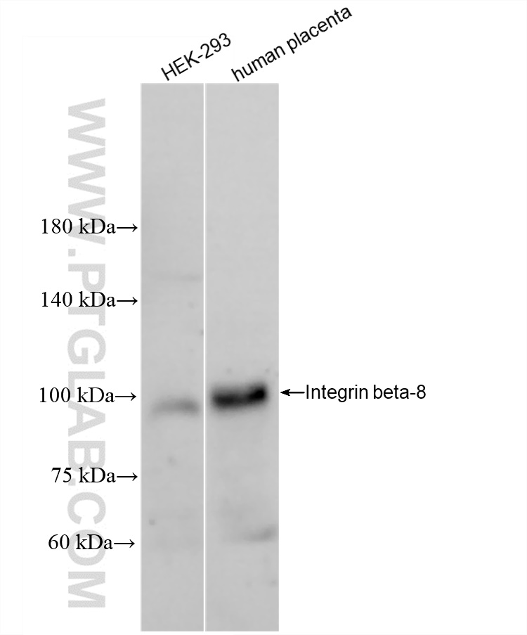 Western Blot (WB) analysis of various lysates using Integrin beta-8 Recombinant antibody (84558-1-RR)