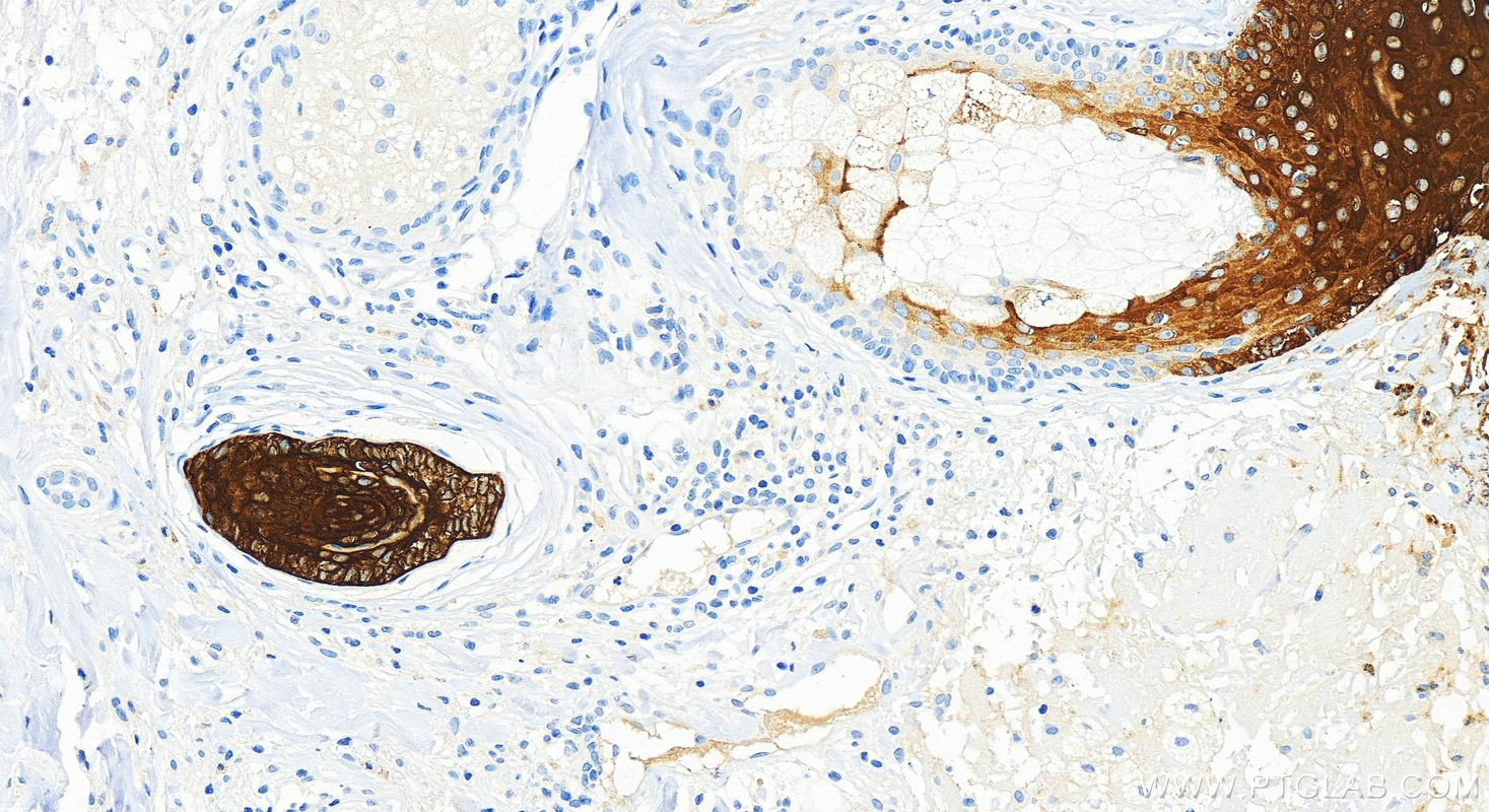 Immunohistochemistry (IHC) staining of human skin tissue using Involucrin Recombinant antibody (83649-5-RR)