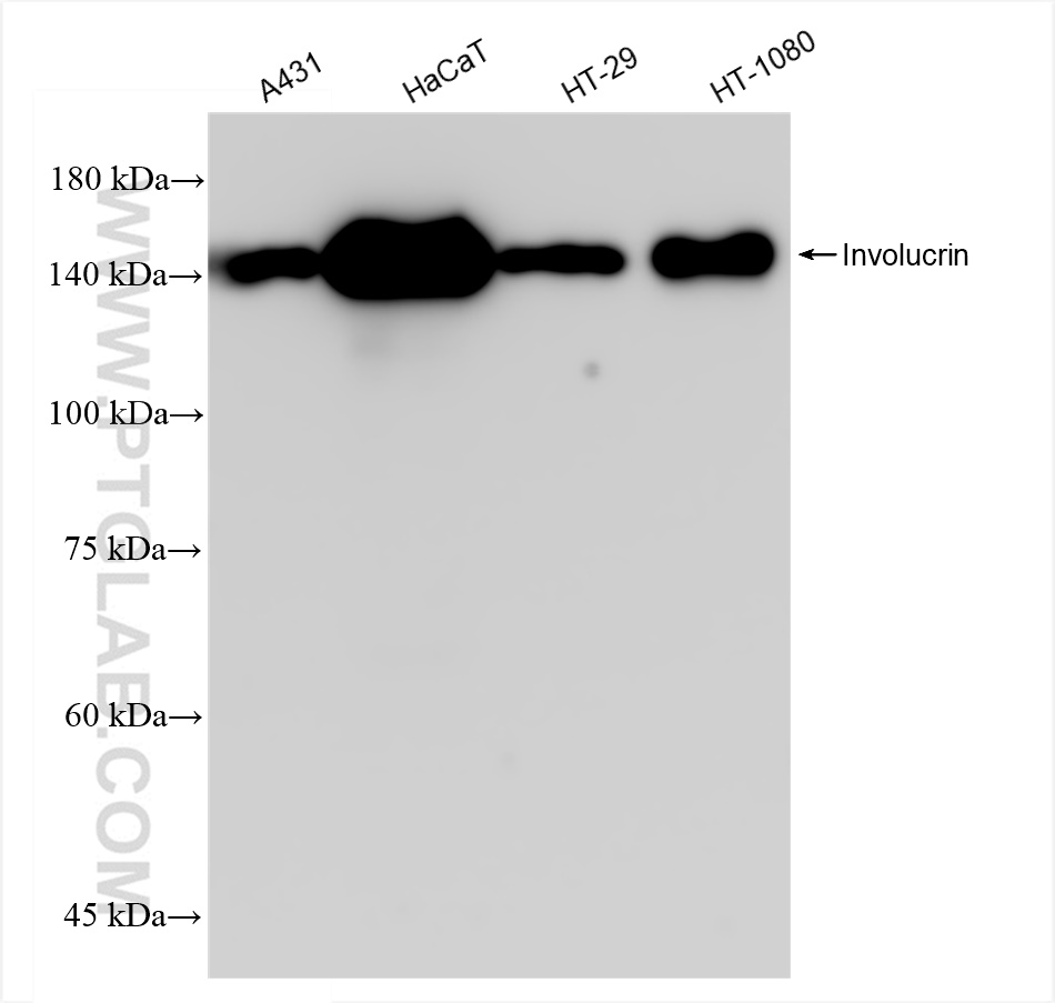 Western Blot (WB) analysis of various lysates using Involucrin Recombinant antibody (83649-5-RR)