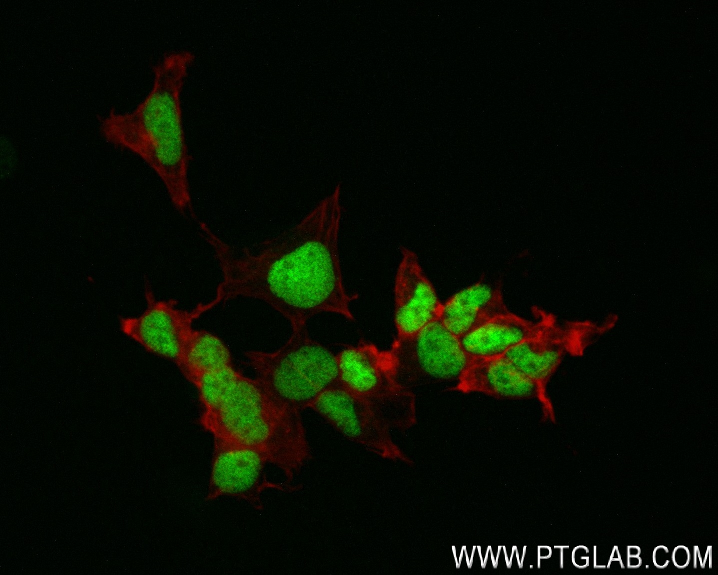 Immunofluorescence (IF) / fluorescent staining of SH-SY5Y cells using Islet 1 Recombinant antibody (83784-4-RR)