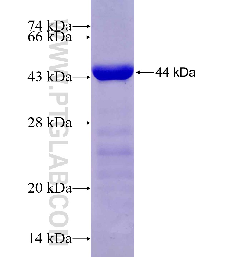 JAKMIP1 fusion protein Ag4999 SDS-PAGE