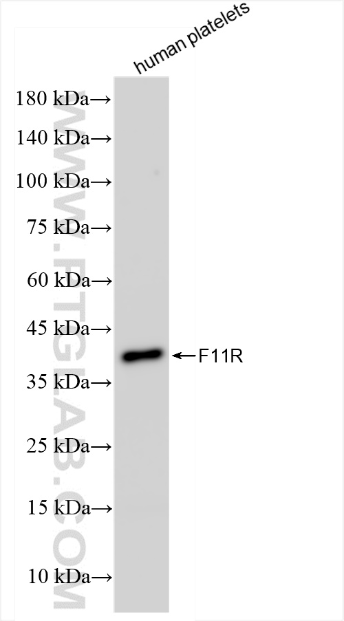 Western Blot (WB) analysis of human peripheral blood platelets using JAM-A/Junctional Adhesion Molecule A Recombinant a (84720-2-RR)